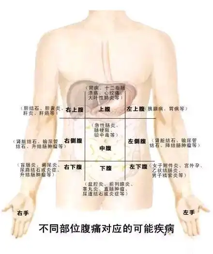 不同部位腹痛对应的可能疾病
