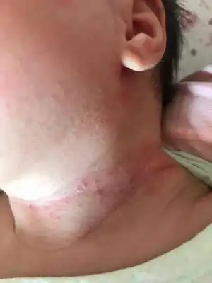 问答 婴儿期0-1岁 宝宝树孕育 90%的妈妈正在使用 宝宝树孕育 90%的