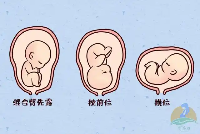各种胎位