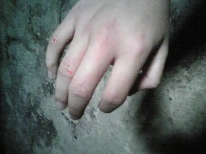 上一次我打架打到手出血,今次我打沙包打出血!