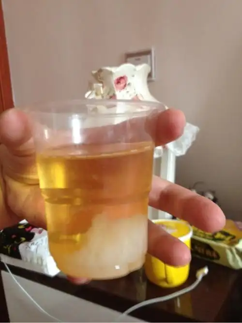 各位妈咪们,用晨尿测男女准吗,这个结果是