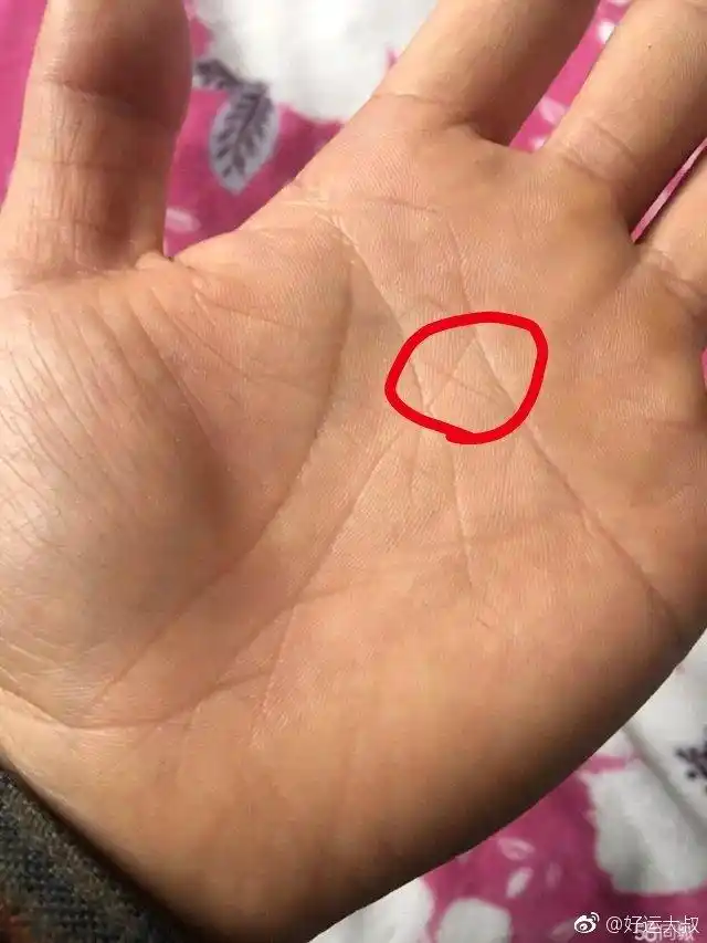 这个地方是心区的位置,那这个十字纹就代表着你会有心率不齐