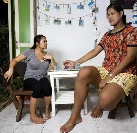 盘点那些女巨人:身高超2米生活各种不便