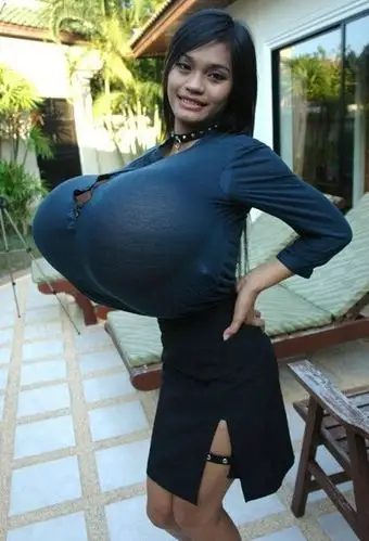 25岁女孩患巨乳症很受伤 全球"胸器逼人"的大胸妹们【组图】