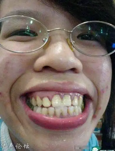 最丑的女人图片:盘点网络上的丑女人20个