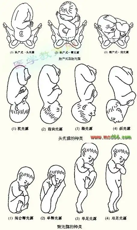 7月:胎宝宝的头位以基本房屋朝向正下方.