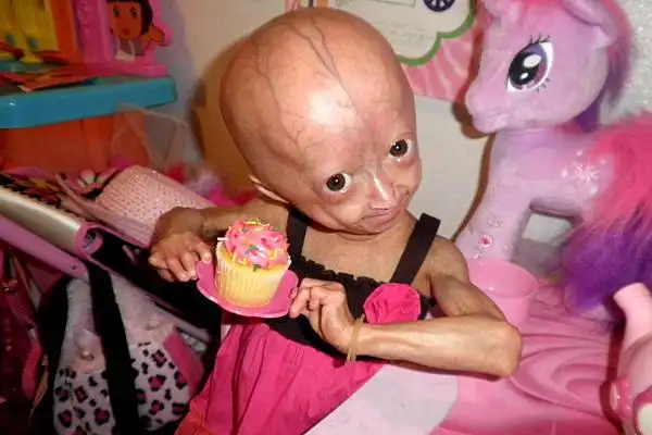 sokan t dj az reg testben kisl t