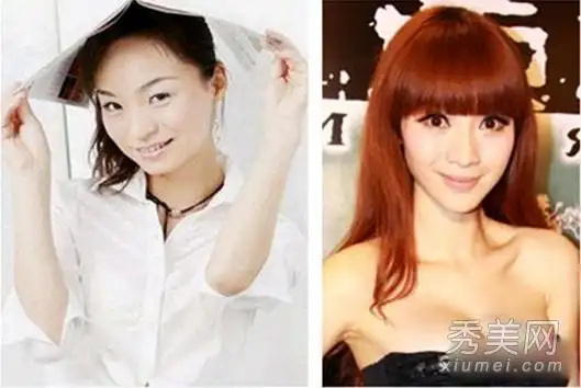 柳岩整容 前后对比