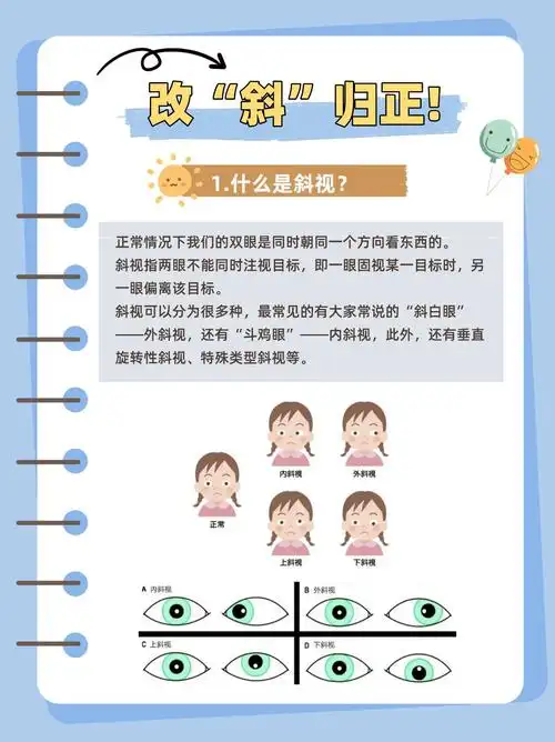 📢改"斜"归正,警惕儿童斜视❗