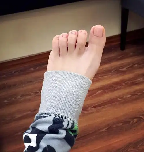 却要穿37甚至38的鞋子… 很多时候鞋子太肥却不够长,就因为大脚趾在