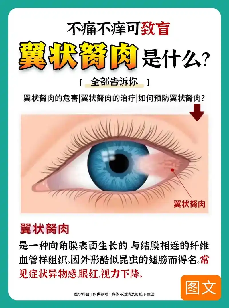 你眼睛的白眼球上有长"一小坨肉"吗?翼状胬肉 - 抖音