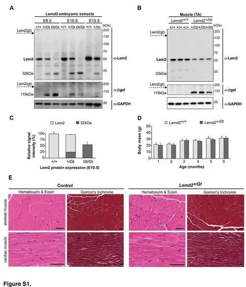 nuclear envelope protein lem2 is required for mouse development
