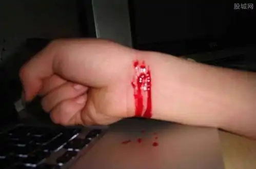 奇葩夫妻小事吵架后女子割腕自杀丈夫不知去向