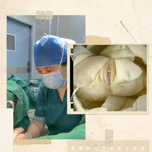 阴唇手术怎么做?