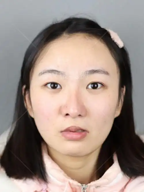 【全肋颗粒软骨唇裂鼻修复-术后3个月】