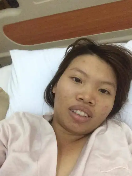 女子嫌弃自己太丑花了20万整容,最后美到让人窒息