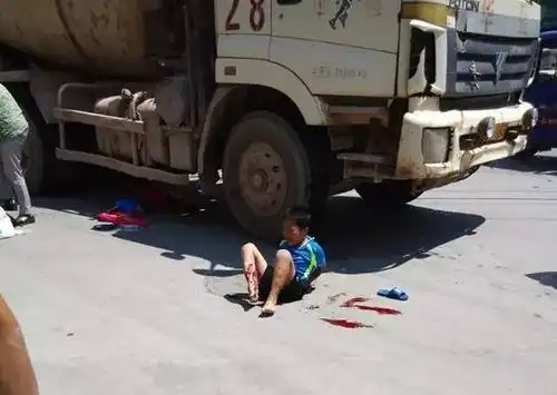 乐都三叉路口又发生一起交通事故,8岁小男孩腿被压断!