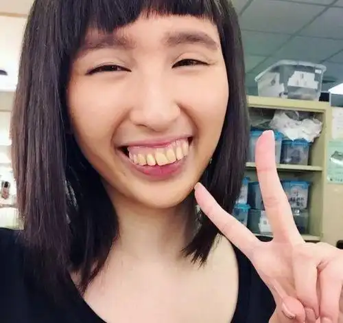 在陈慧珊,黄智贤主演的时装剧《波士早晨》里演一位龅牙丑女