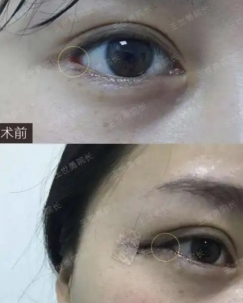 开眼外眼角图片