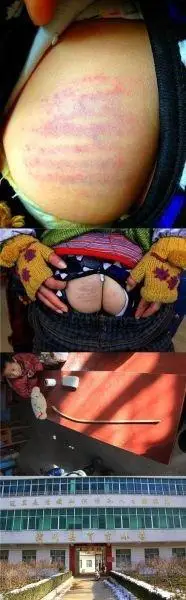 (周五)下午,潢川县弋阳办事处民办育苗小学发生一起教师体罚学生事件