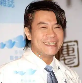 你是地包天都以为明星好当原来偷偷做了截骨术