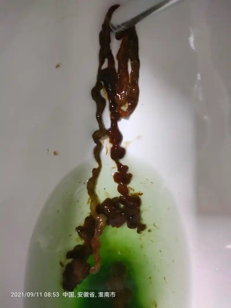 减肥 这是减肥排出来的便便,有谁知道这是啥东西?