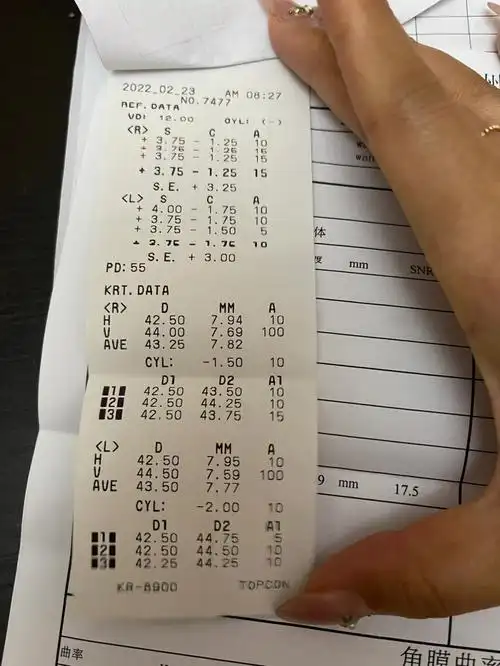 请问孩子散光该怎么办