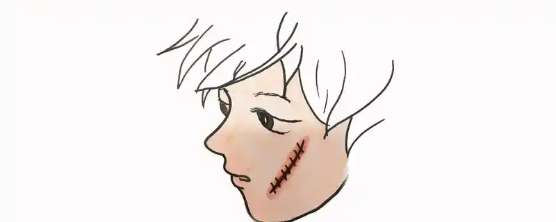 伤疤怎么画简单