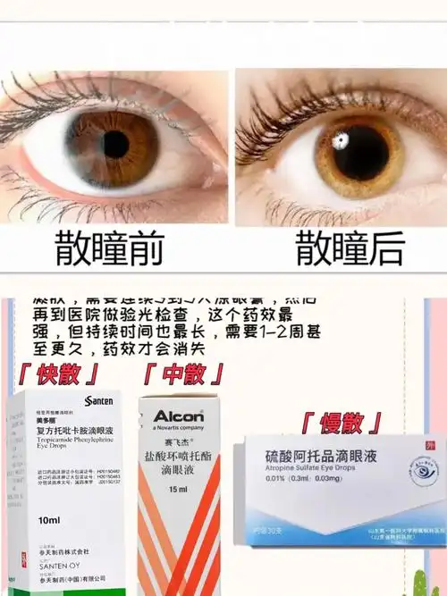 散瞳对比  #快速散瞳  #散瞳药  #散瞳药有哪些  #散瞳眼药水 #散瞳