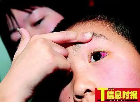 小学生迟到遭被师打伤眼睛 家长索赔两万(图)