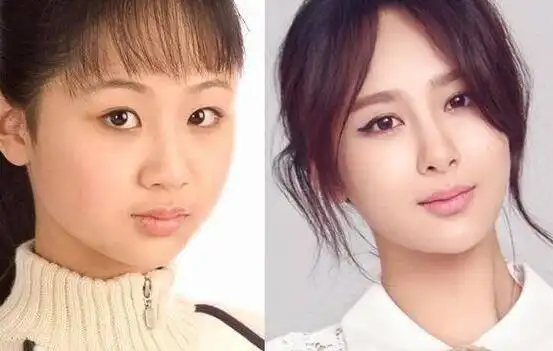 娱乐圈女星出道前,后对比照片差别太大,堪称"换头"!