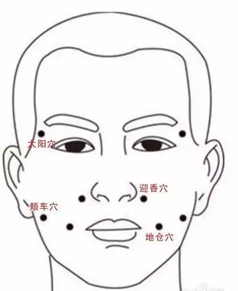 面瘫怎么治疗?巧用三棱针