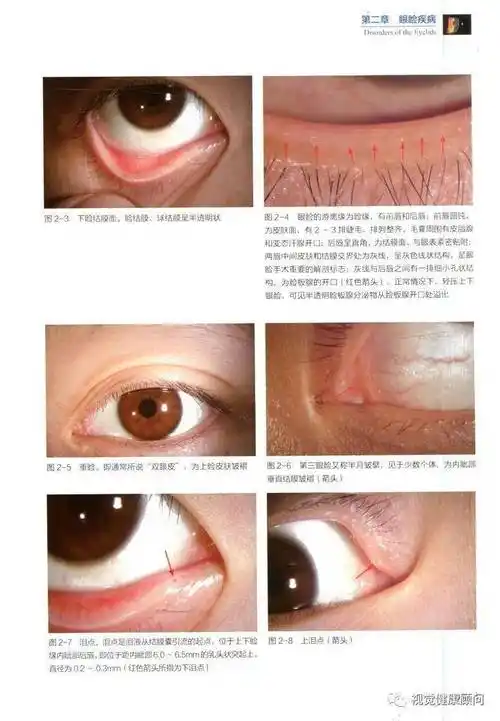 眼睛各部位正常值赶快收藏