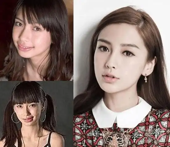 明星整容前后对比照 男爱隆鼻 女爱削骨