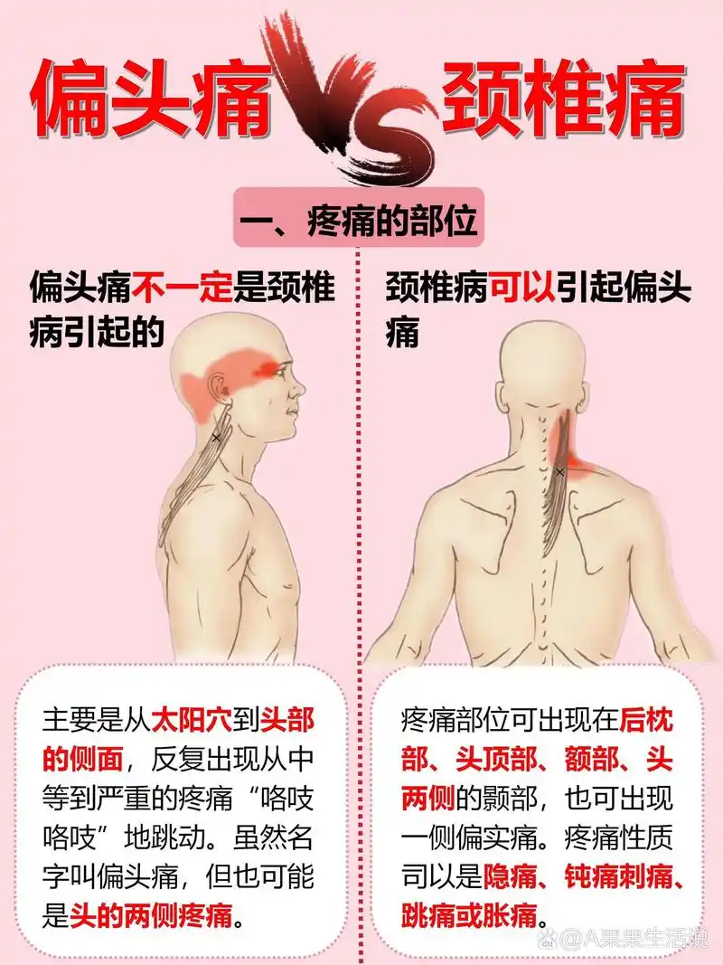 颈椎病真的会引起偏头痛啊!