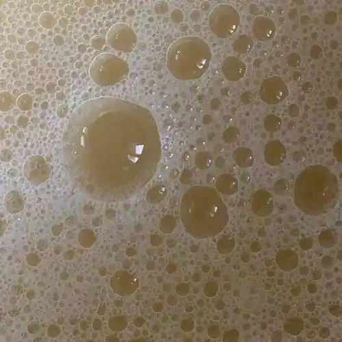 这些白带都算异常包括脓性水样有血丝华克维两性霉素b阴道泡腾片去炎