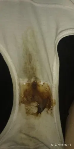 加妈咪!怀孕初期白带症状"大名鼎鼎"-第1张图片-木瓜博客