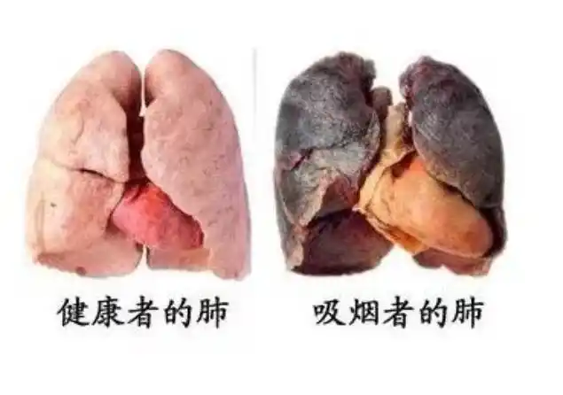 经常抽烟的人,若能在这个年龄段前戒烟,或许肺部能恢复正常
