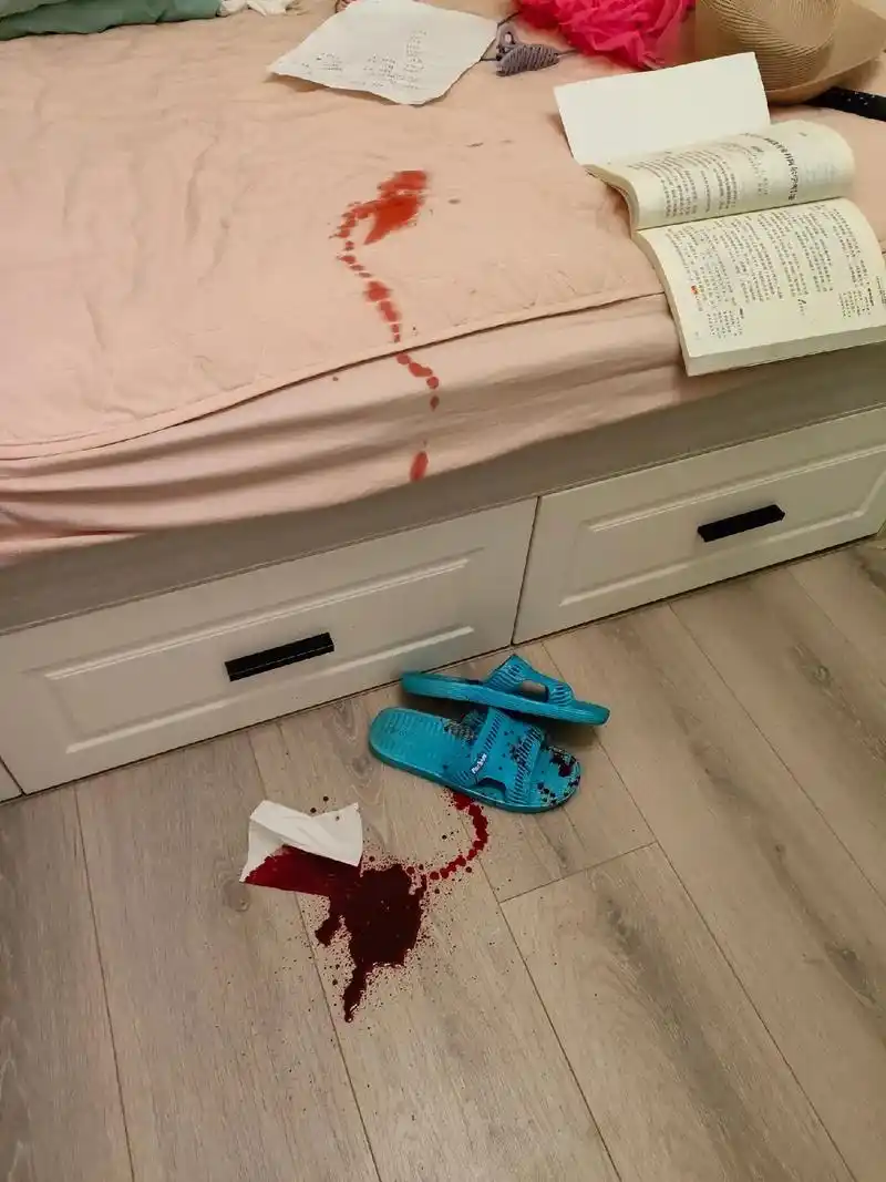 看到这一地的血吓的我不知所措,到医院后医生说再来迟点伤口就愈 - 抖