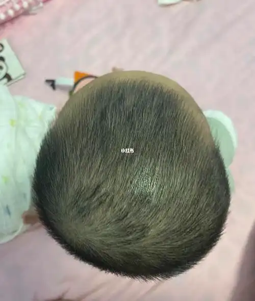 6个半月vs7个半月宝宝头型