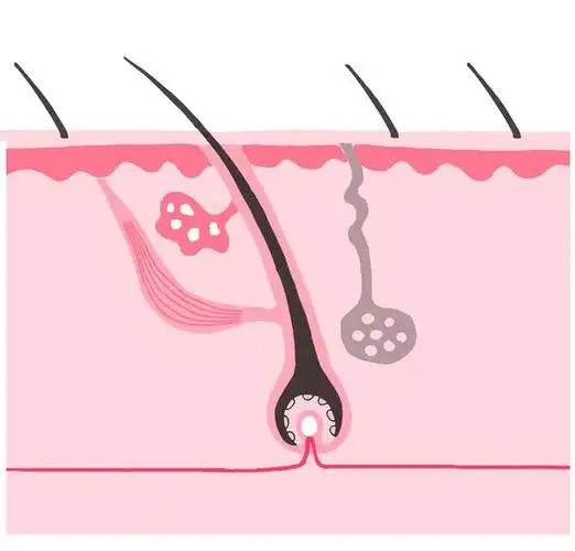 危害毛孔的敌人:油脂和污垢!如何清除堵塞毛孔的威胁?