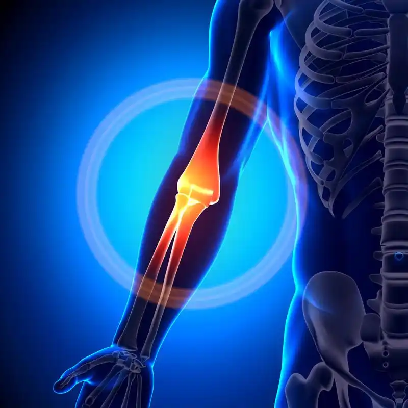 手肘解剖学-解剖学骨头