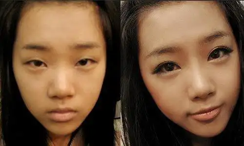 两眼无神目光呆滞原因_两眼无神目光呆滞原因 中医辨证