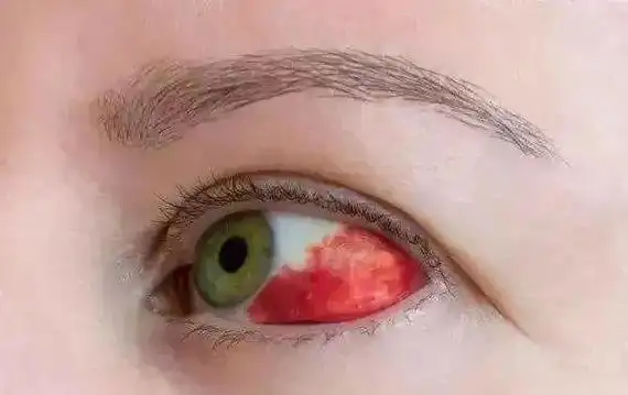 患糖尿病8年双目失明,真相令人唏嘘,这些弯路,你一定不要走!