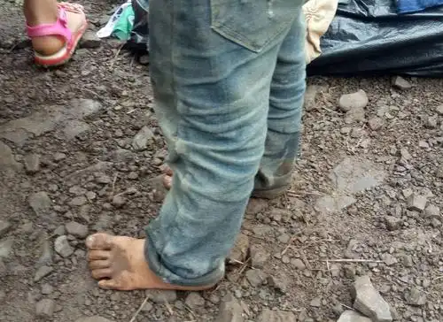 那个冬天赤脚的小孩.