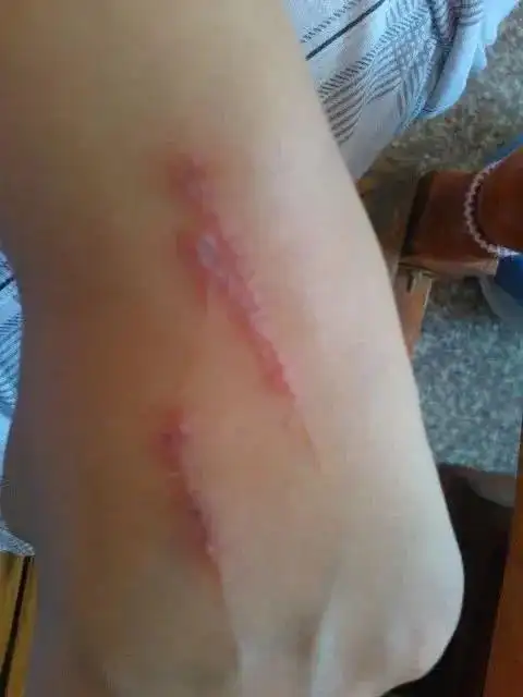 隐翅虫又被称为"影子虫","青腰虫",状似白蚁,体长约0.5~1.