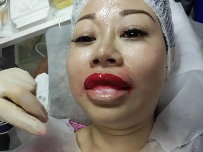 上部分做完,同样涂舒缓敷着