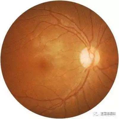 人的眼底有一个叫中心凹的"小坑",为什么会长成这样?