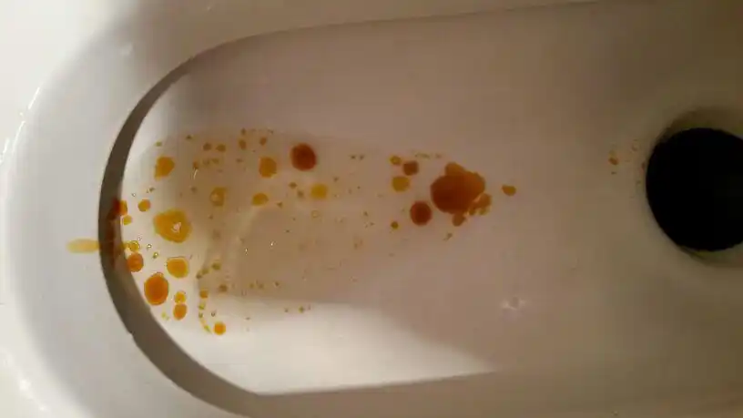 排油,溶解脂肪,才能真正得瘦下来!_商家圈·全