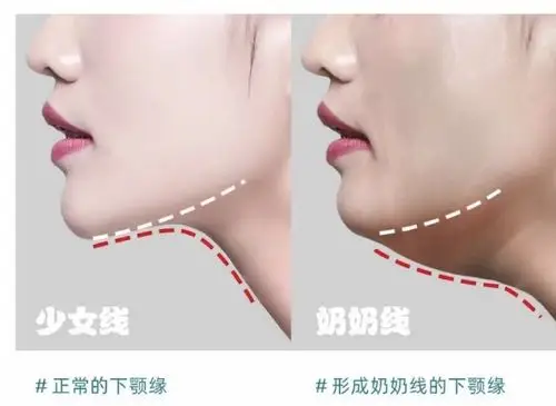 下颌线在哪